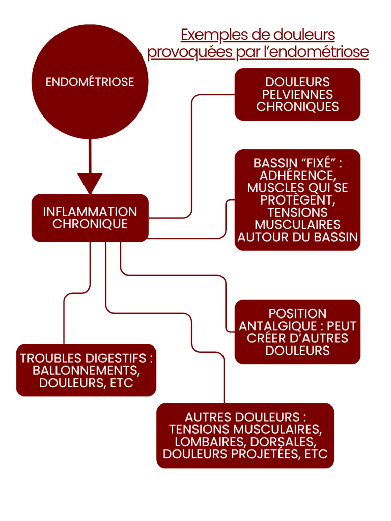 Douleurs provoquées par l'inflammation chronique dans le cas de l'endométriose